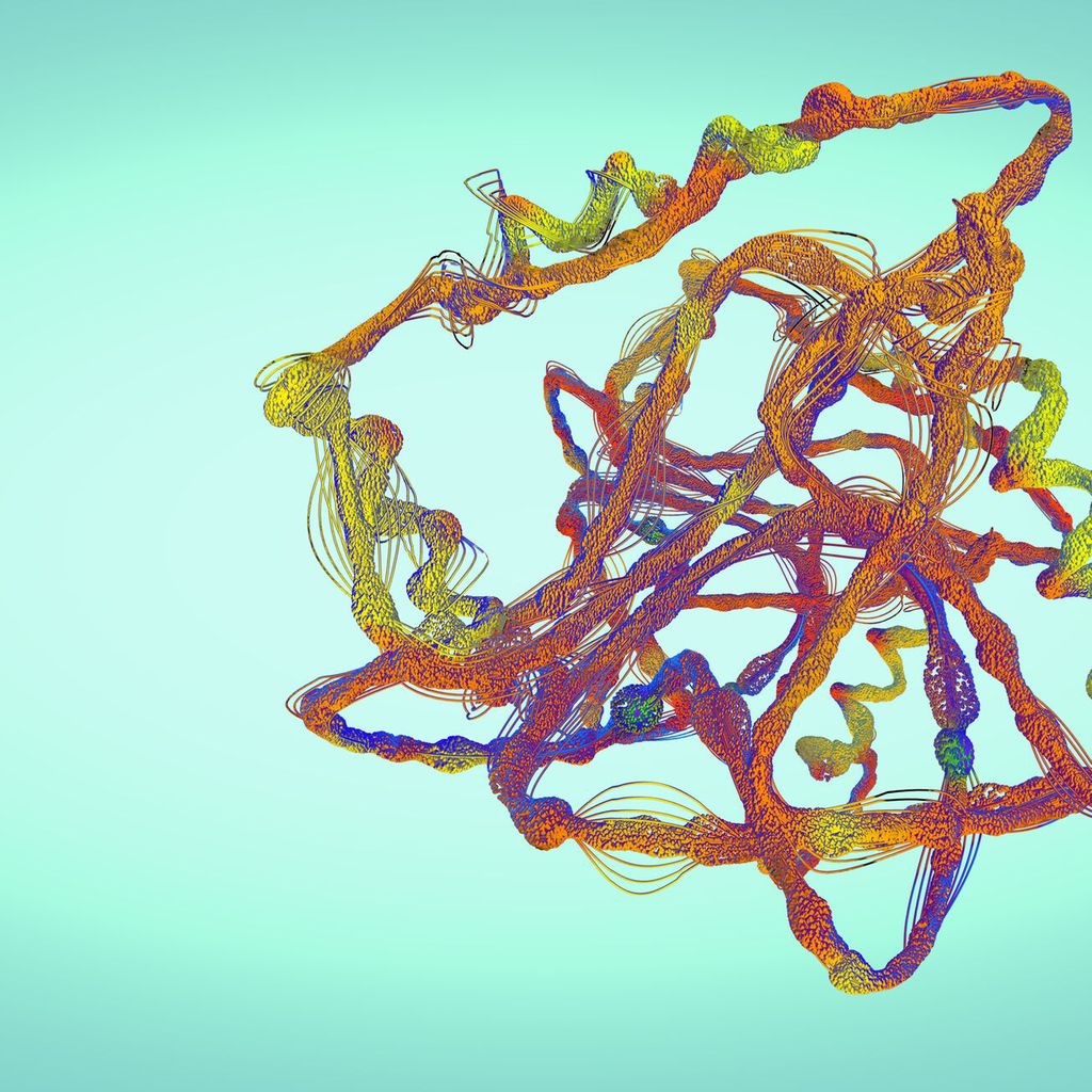 Komplexe Zusammenhänge in der Therapie von ALAmyloidosen Onkologie